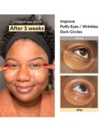 Abib Collagen Eye Patch - Image 2