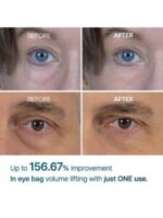 Dr.Melaxin Eyephalt Eyebag Cream - Image 2